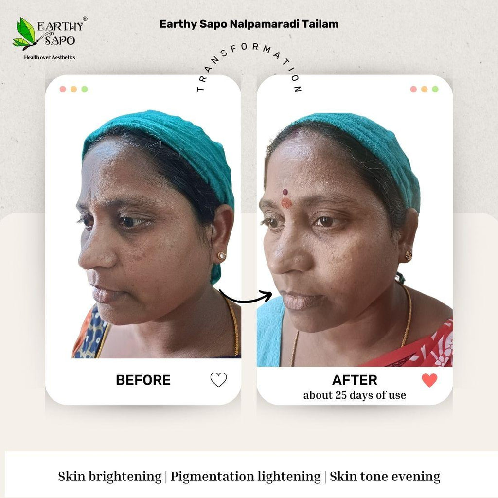 Earthy Sapo Nalpamaradi Tailam before and after showing skin smoothing, blemish appearance and skin nourishment comparison