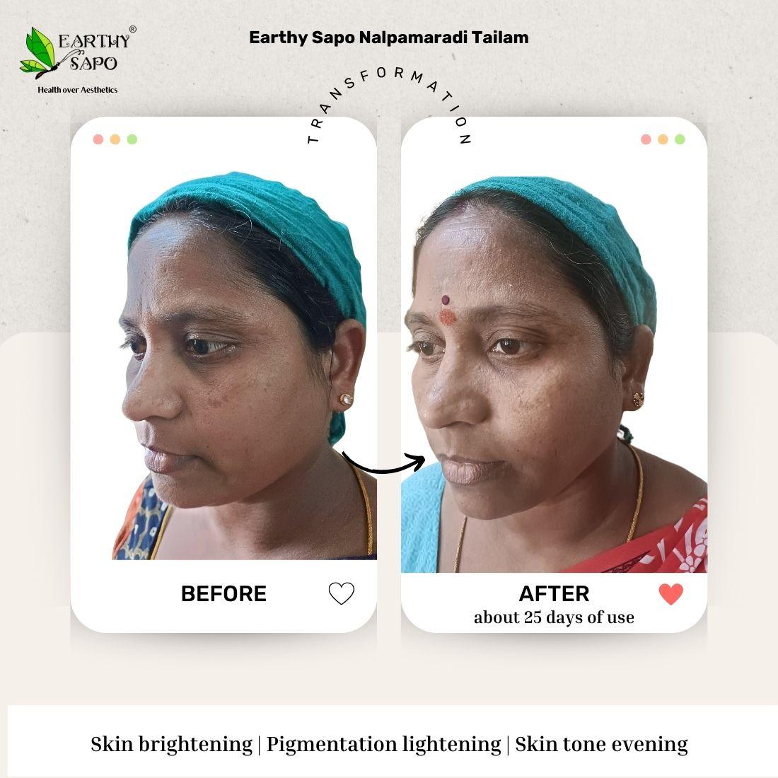 Earthy Sapo Nalpamaradi Tailam before and after showing skin smoothing, blemish appearance and skin nourishment comparison