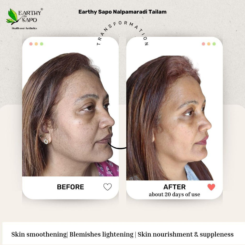 Earthy Sapo Nalpamaradi Tailam before and after showing skin smoothing, blemish appearance and skin nourishment comparison