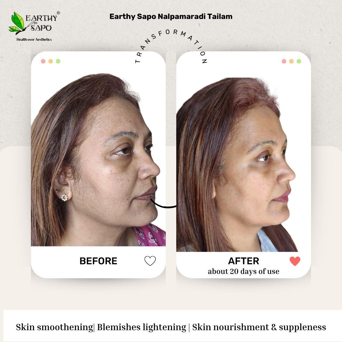 Earthy Sapo Nalpamaradi Tailam before and after showing skin smoothing, blemish appearance and skin nourishment comparison
