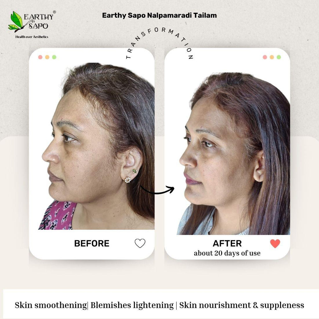 Earthy Sapo Nalpamaradi Tailam before and after showing skin smoothing, blemish appearance and skin nourishment comparison