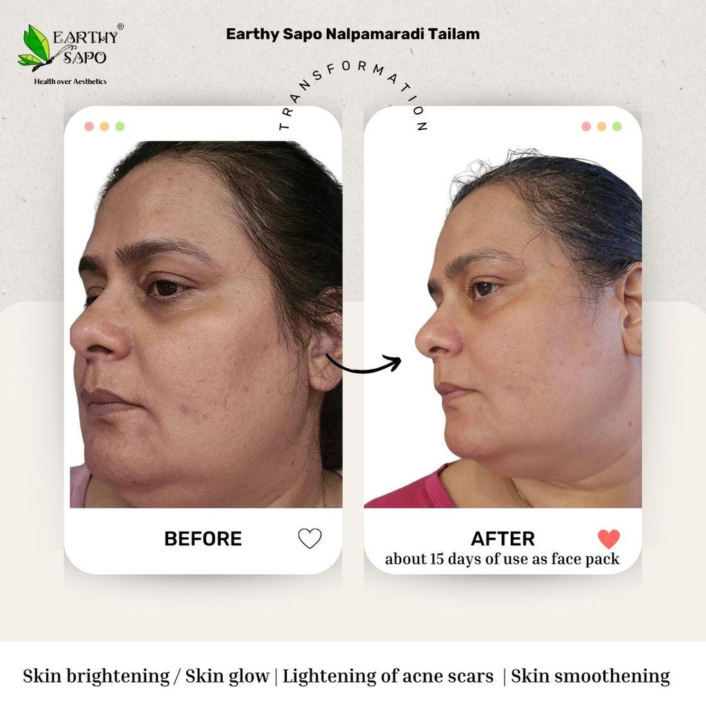 Earthy Sapo Nalpamaradi Tailam before and after showing skin tone, pigmentation and skin softness comparison