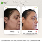 Earthy Sapo Nalpamaradi Tailam before and after showing skin tone, pigmentation and skin softness comparison