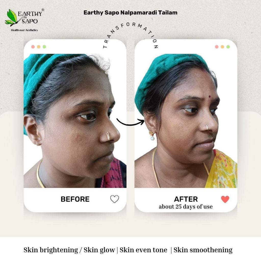 Earthy Sapo Nalpamaradi Tailam before and after showing skin tone, pigmentation and skin softness comparison