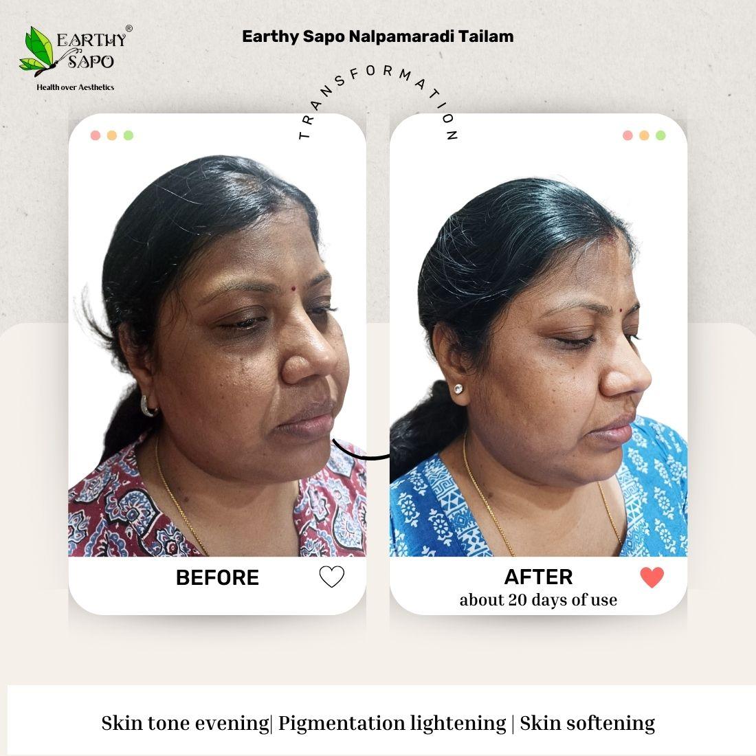 Earthy Sapo Nalpamaradi Tailam before and after showing skin tone, pigmentation and skin softness comparison
