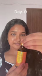 Nalpamaradi Tailam, 25 ml